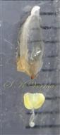  One sepal and anther